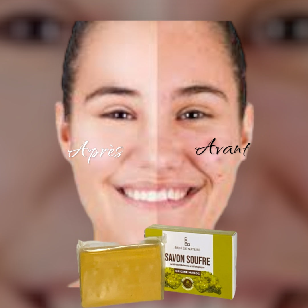 NATURAL SULFUR SOAP